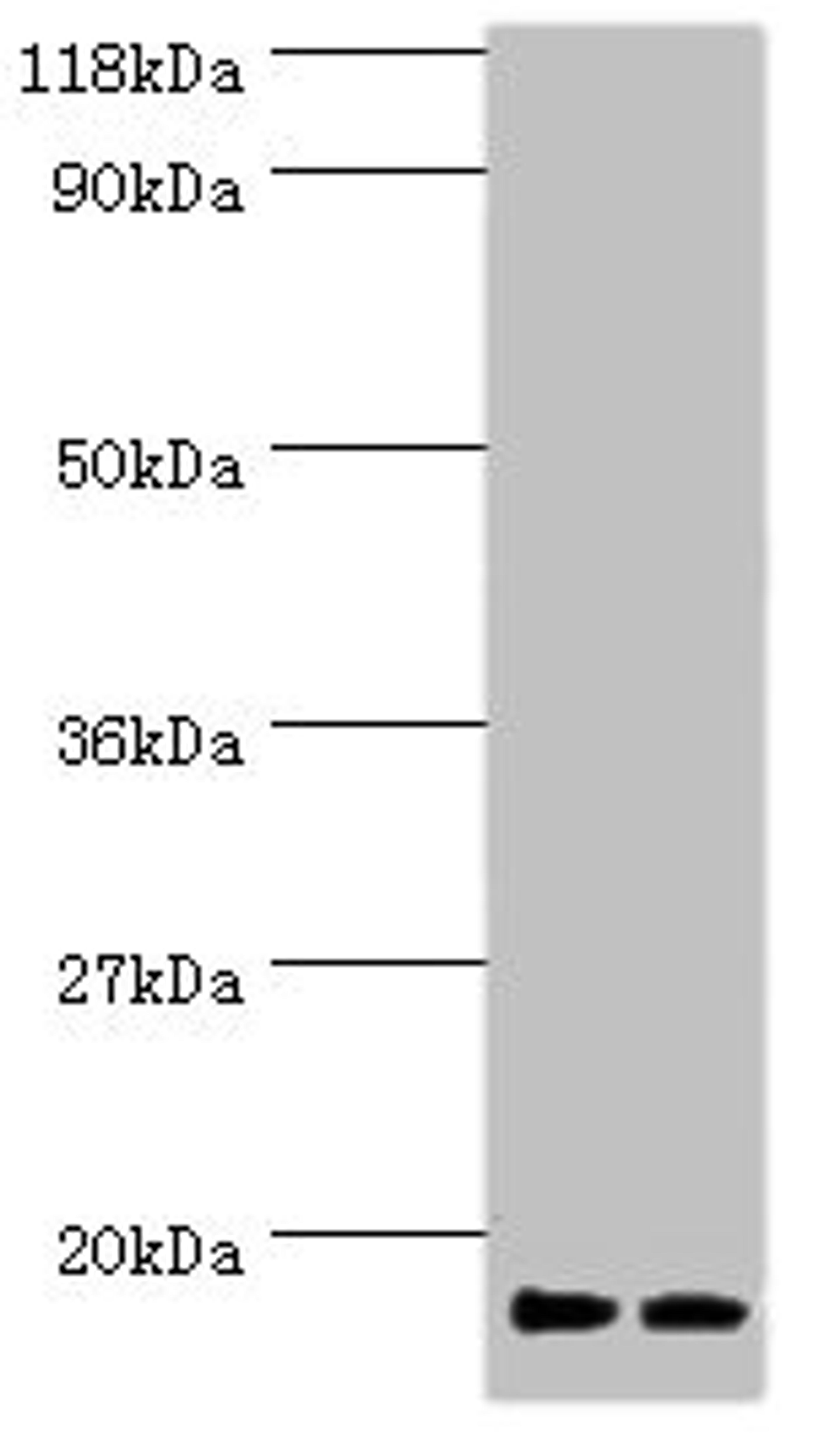 Western blot. All lanes: RPS19 antibody at 2µg/ml. Lane 1: EC109 whole cell lysate. Lane 2: 293T whole cell lysate. Secondary. Goat polyclonal to rabbit IgG at 1/15000 dilution. Predicted band size: 17 kDa. Observed band size: 17 kDa