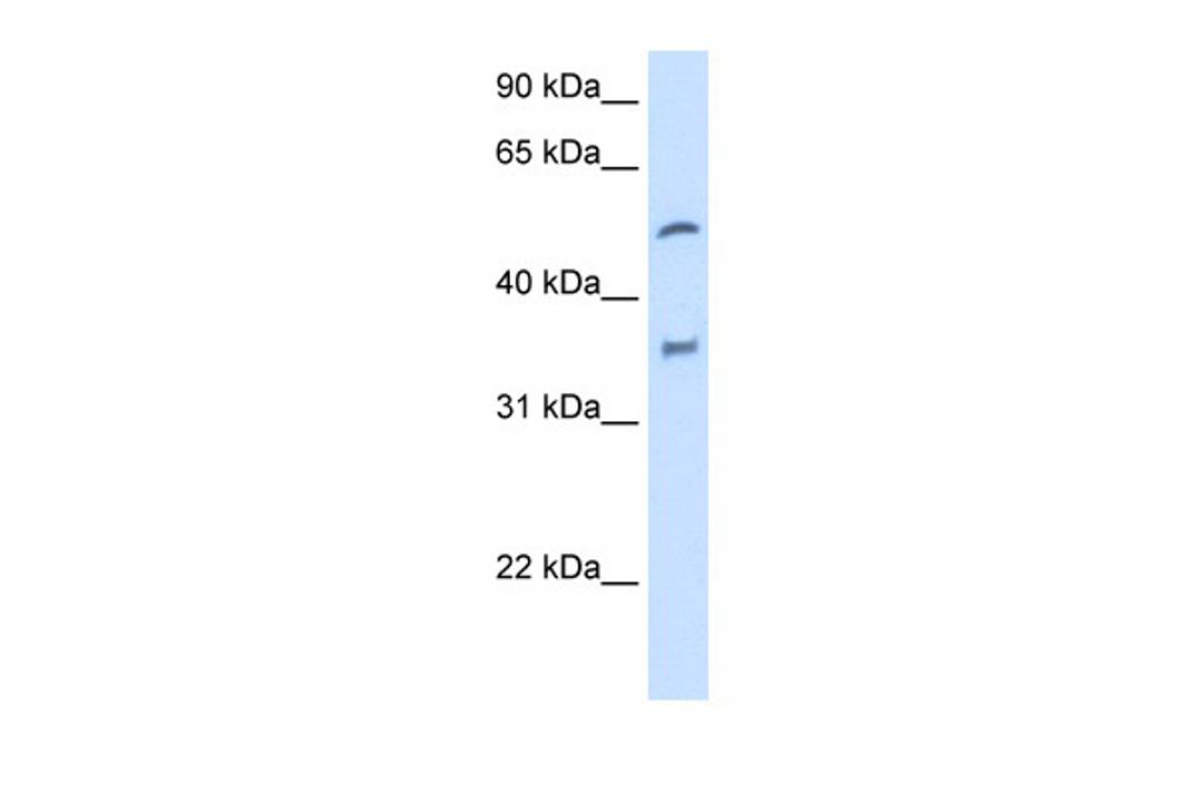 Antibody used in WB on Human Liver at 2.5 ug/ml.