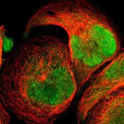 Immunocytochemistry/Immunofluorescence: TAF6 Antibody [NBP1-82774] - Staining of human cell line A-431 shows positivity in nucleus & cytoplasm.