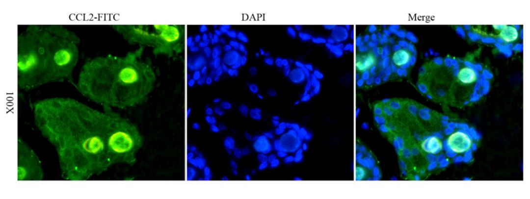 IF image of rat skin tissue using MCP1 antibody (primary antibody at 1:100)