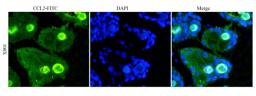 IF image of rat skin tissue using MCP1 antibody (primary antibody at 1:100)