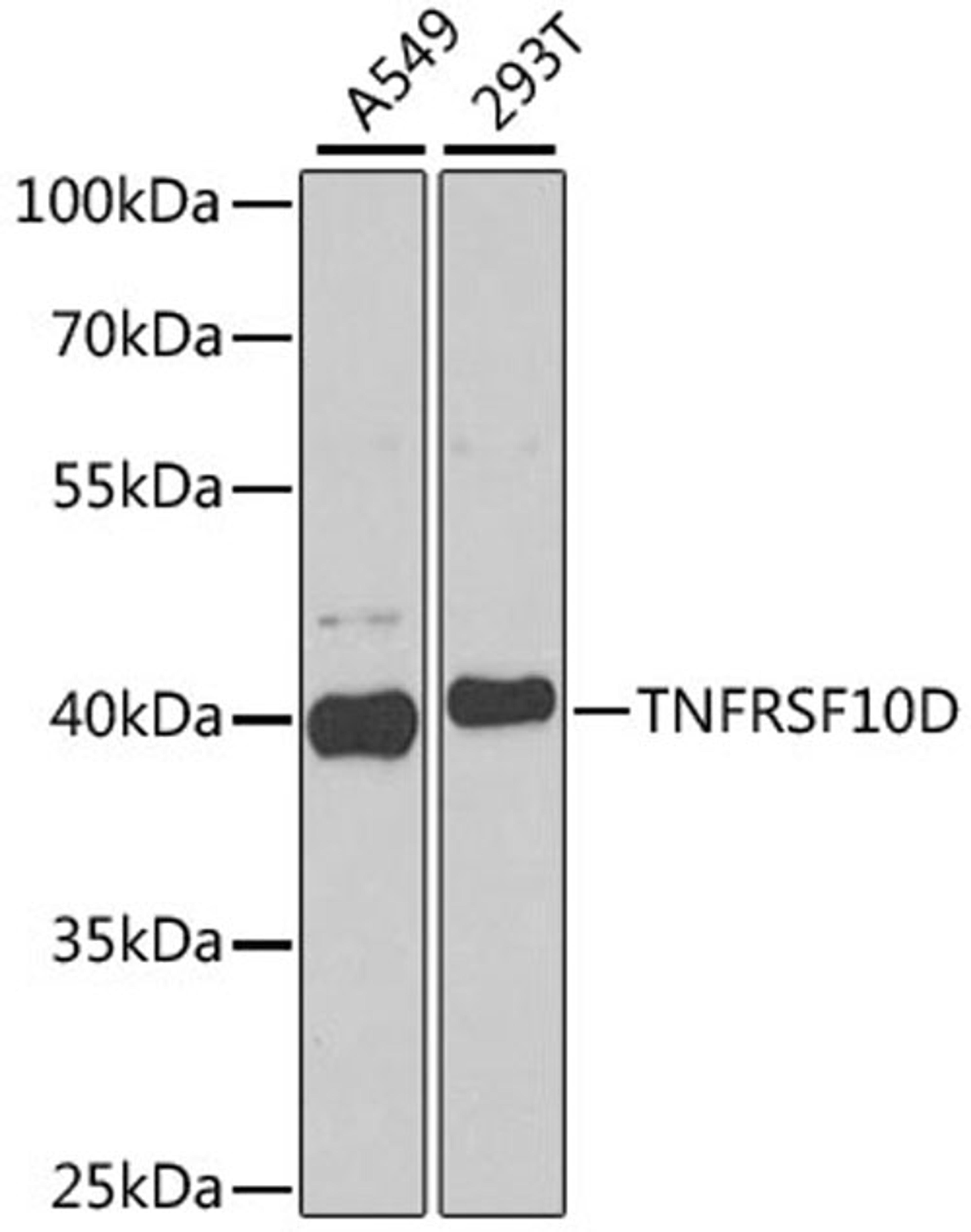 Western blot - TNFRSF10D antibody (A6136)