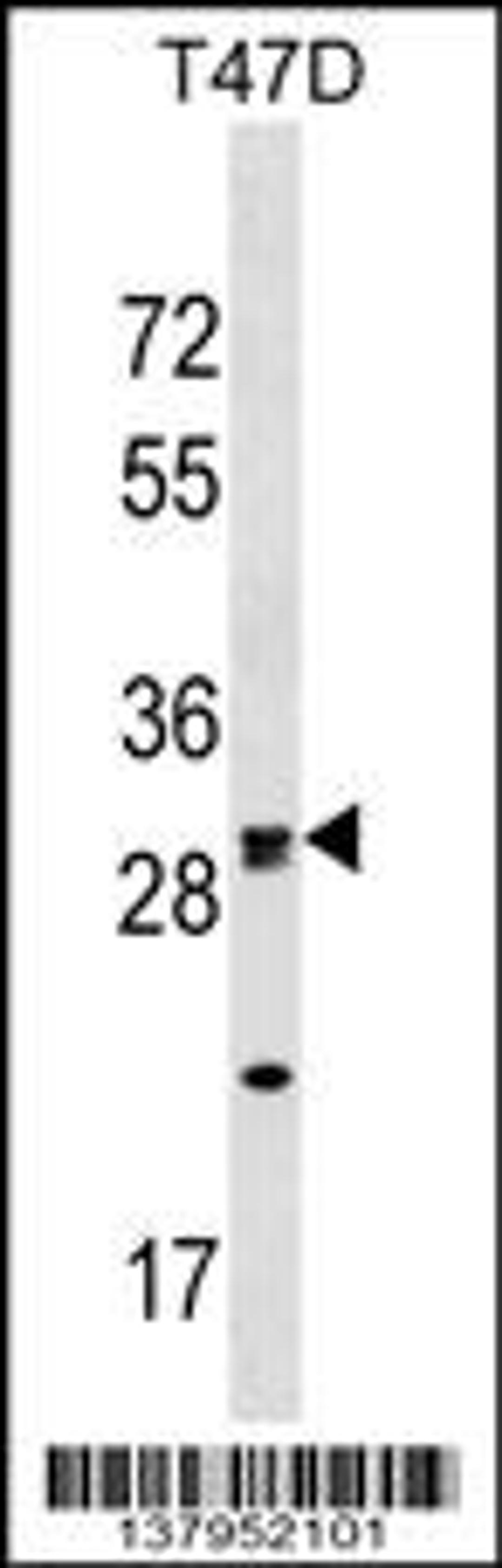 Western blot analysis in T47D cell line lysates (35ug/lane).