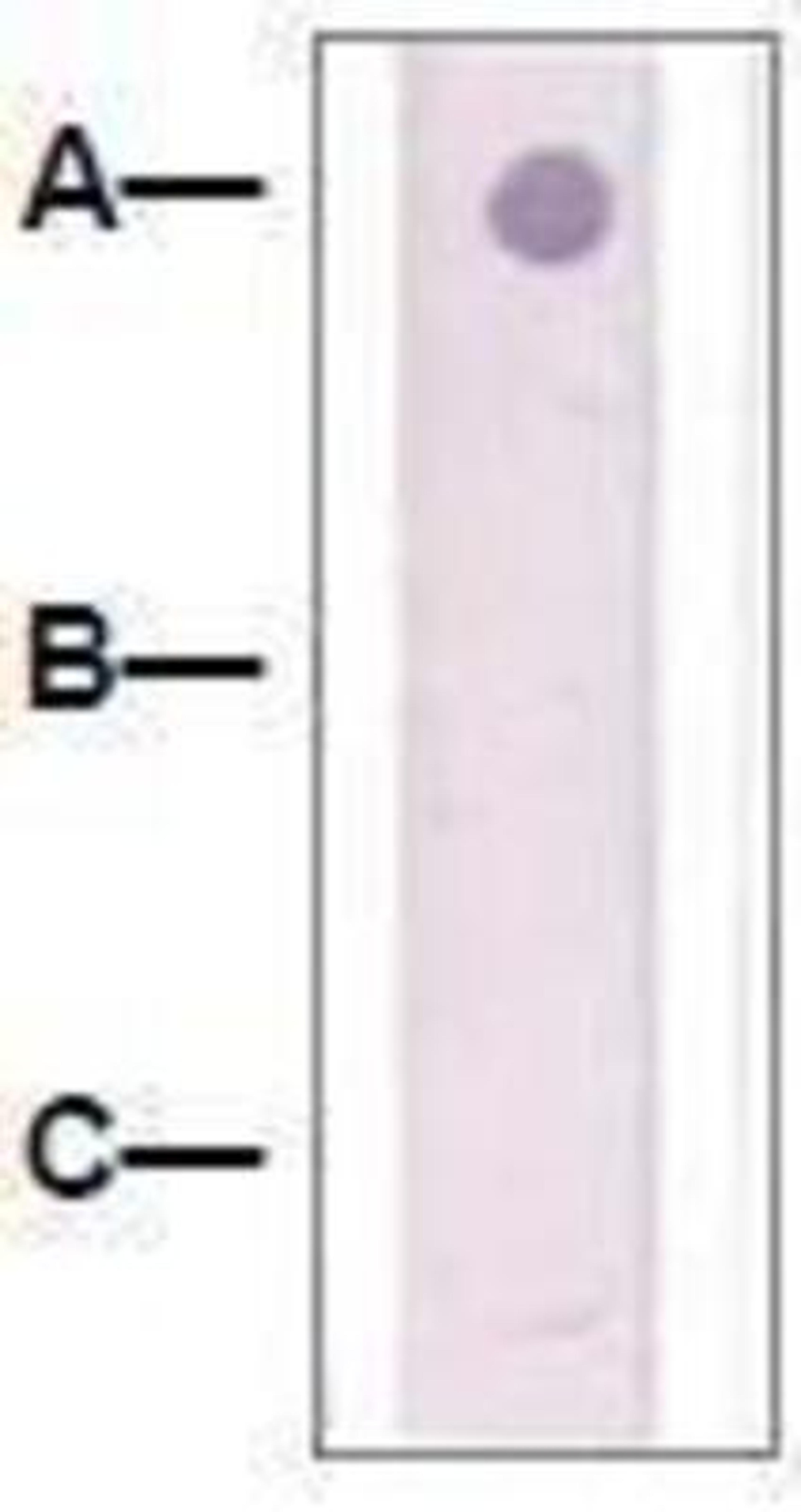 Dot Blot: beta Catenin Antibody [NBP1-73991] - 1 mg peptide was blot onto NC membrane: A: Beta-Catenin (pY228) / B: Beta-Catenin (Non-Phospho) / C: Non-related Phosphopeptide.  Followed by immunoblotting Rabbit anti-beta-Catenin (pY228) at 1:1000.