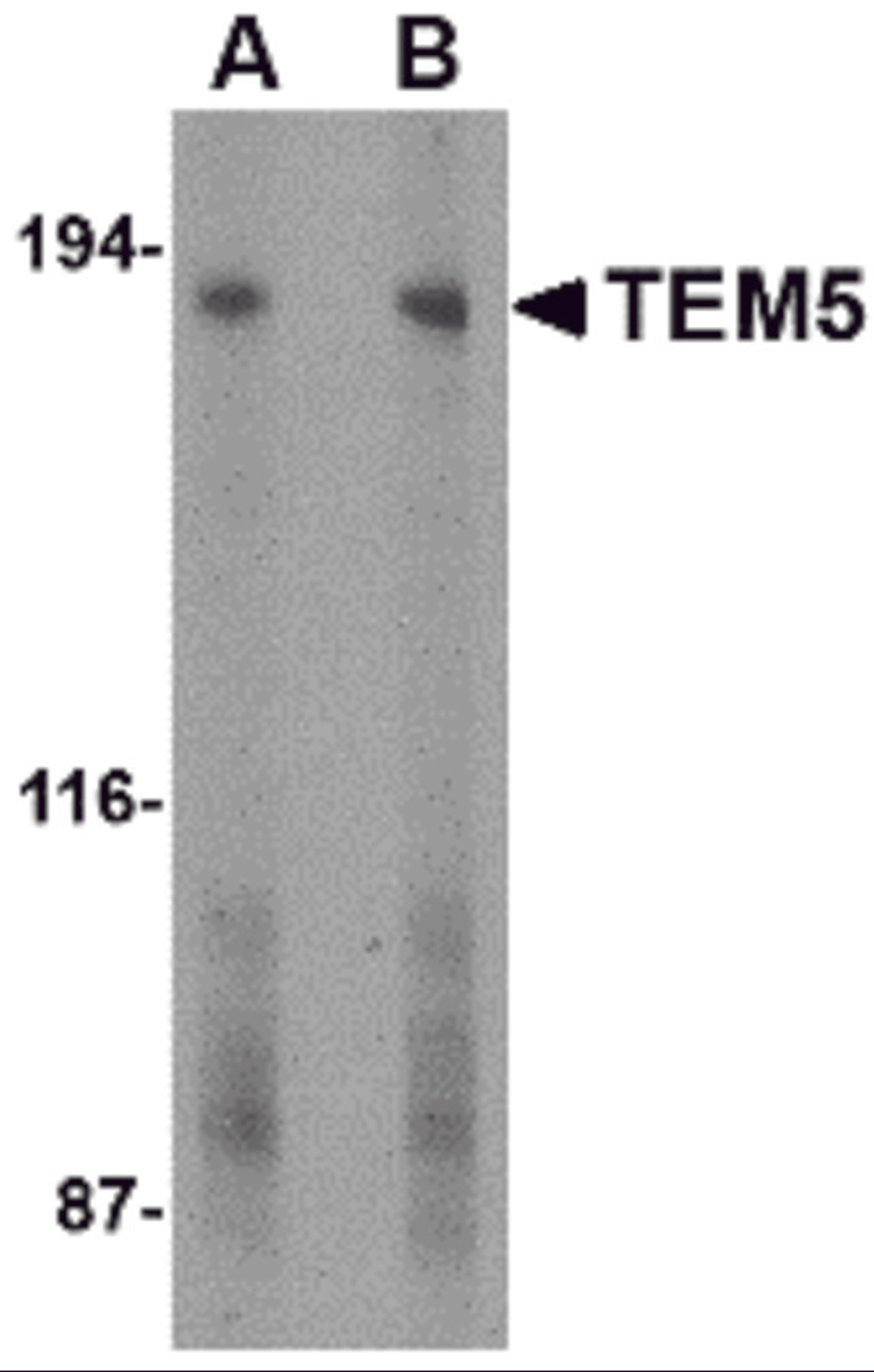 Western blot analysis of TEM5 in human bladder tissue lysate with TEM5 antibody at (A) 2 and (B) 4 &#956;g/mL.