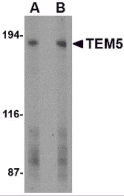 Western blot analysis of TEM5 in human bladder tissue lysate with TEM5 antibody at (A) 2 and (B) 4 μg/mL.
