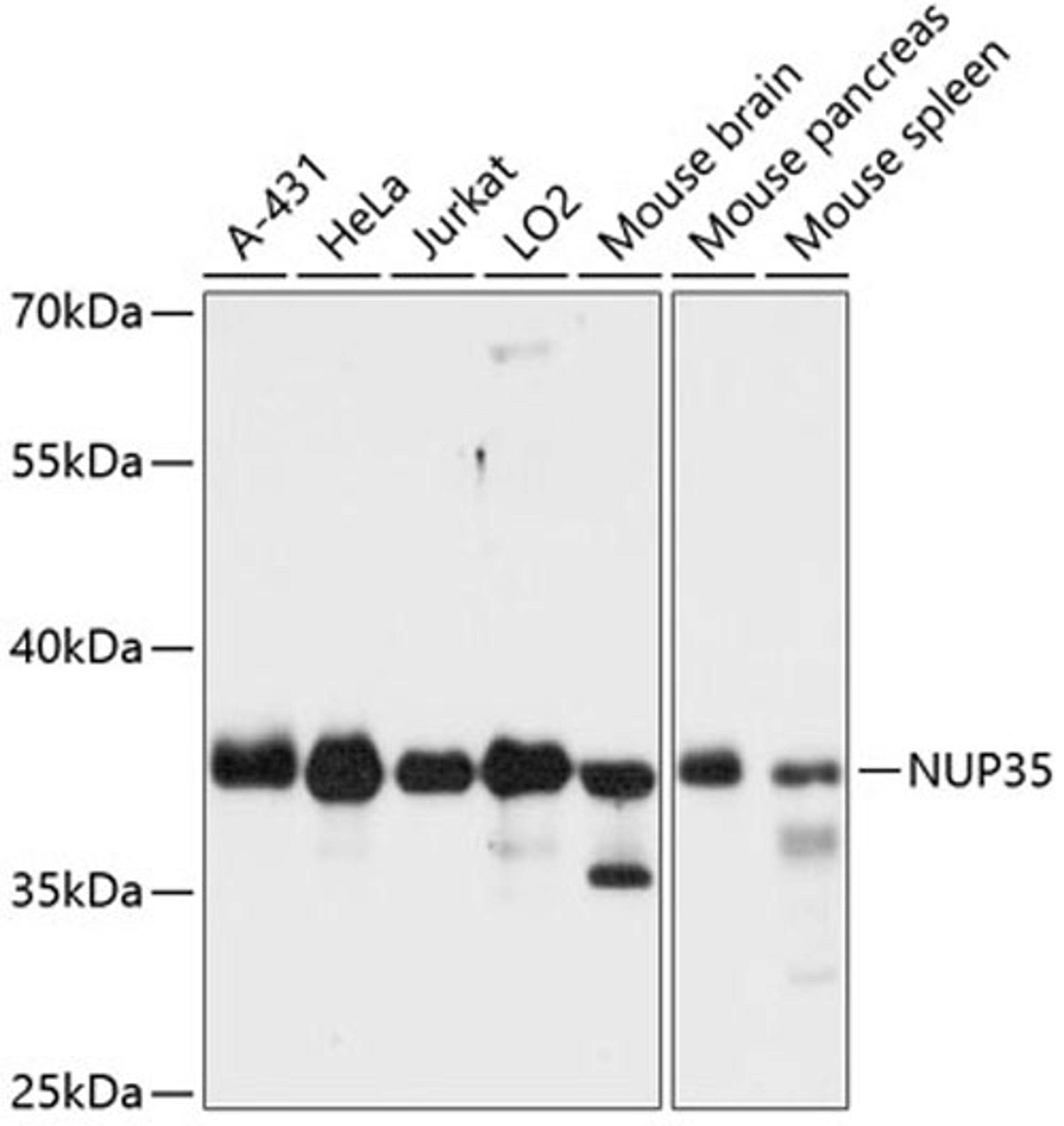 Western blot - NUP35 antibody (A12762)