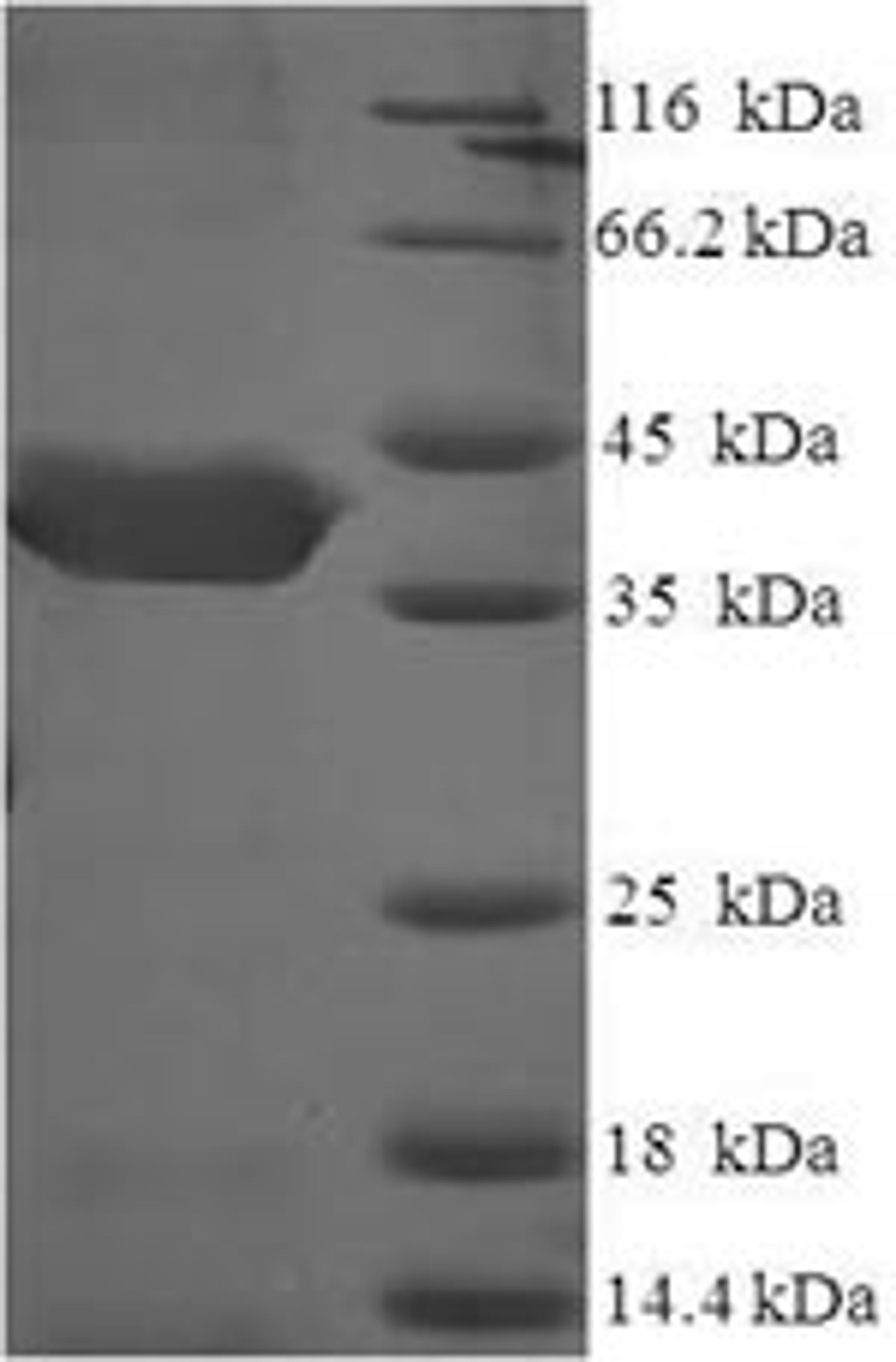 (Tris-Glycine gel) Discontinuous SDS-PAGE (reduced) with 5% enrichment gel and 15% separation gel.