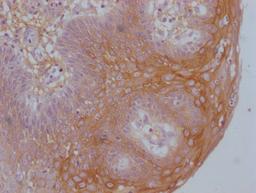 IHC image of CSB-MA192596 diluted at 1:100 and staining in paraffin-embedded human tonsil tissue performed on a Leica BondTM system. After dewaxing and hydration, antigen retrieval was mediated by high pressure in a citrate buffer (pH 6.0). Section was blocked with 10% normal goat serum 30min at RT. Then primary antibody (1% BSA) was incubated at 4°C overnight. The primary is detected by a Goat anti-mouse IgG polymer labeled by HRP and visualized using 0.05% DAB.