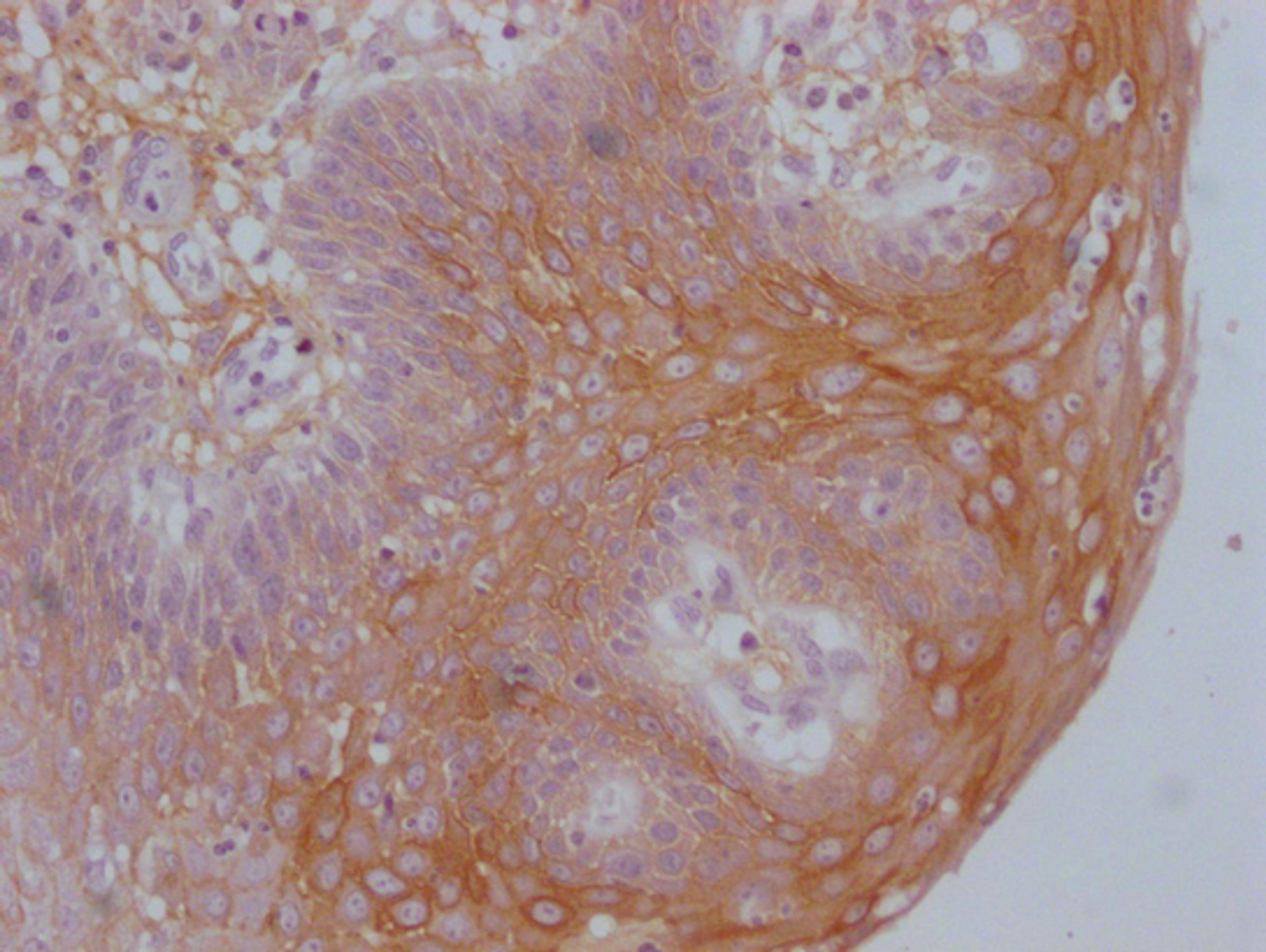 IHC image of CSB-MA192596 diluted at 1:100 and staining in paraffin-embedded human tonsil tissue performed on a Leica BondTM system. After dewaxing and hydration, antigen retrieval was mediated by high pressure in a citrate buffer (pH 6.0). Section was blocked with 10% normal goat serum 30min at RT. Then primary antibody (1% BSA) was incubated at 4°C overnight. The primary is detected by a Goat anti-mouse IgG polymer labeled by HRP and visualized using 0.05% DAB.