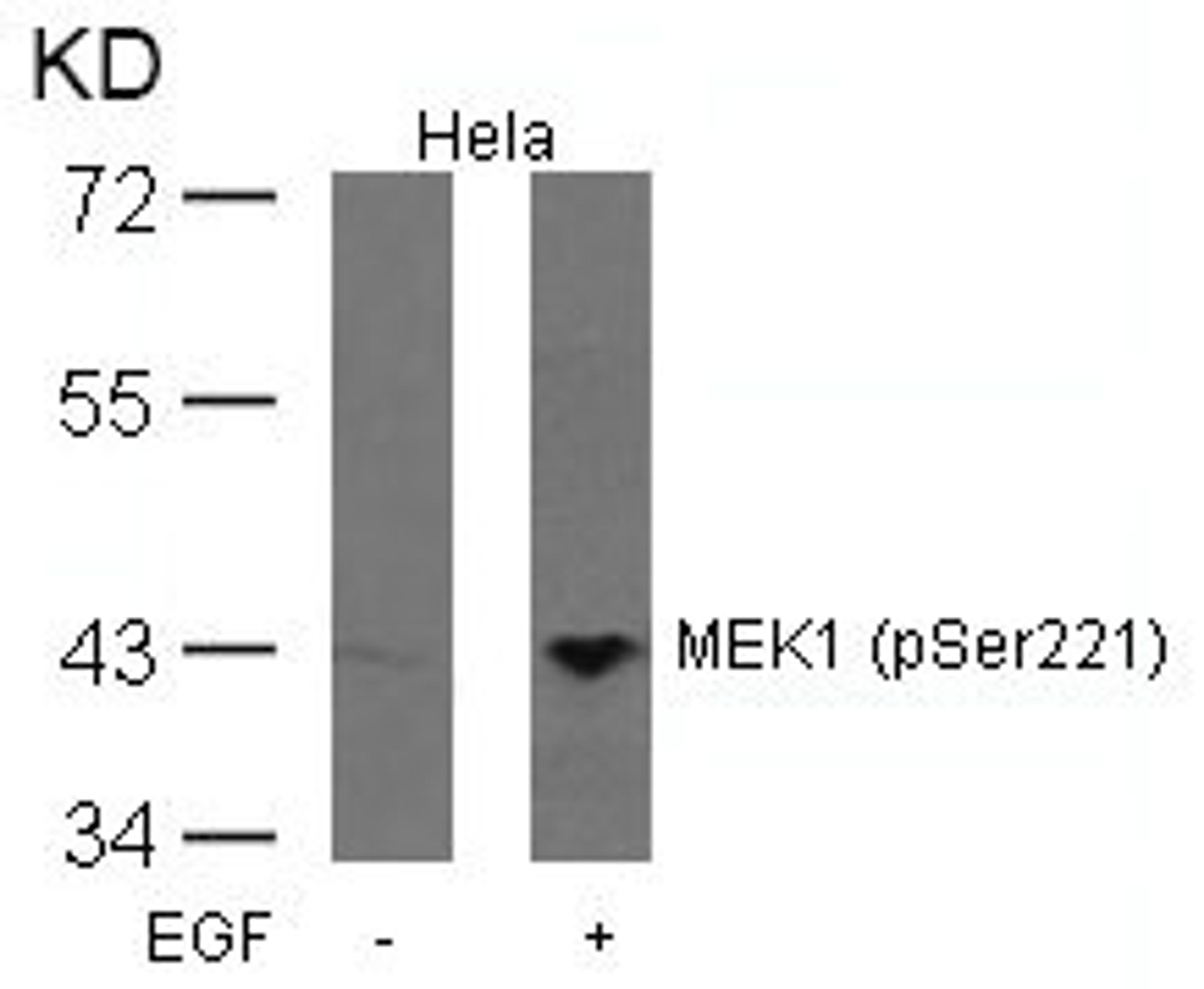 Western blot analysis of extracts from Hela cells untreated or treated with EGF using MEK1(Phospho-Ser221) Antibody.