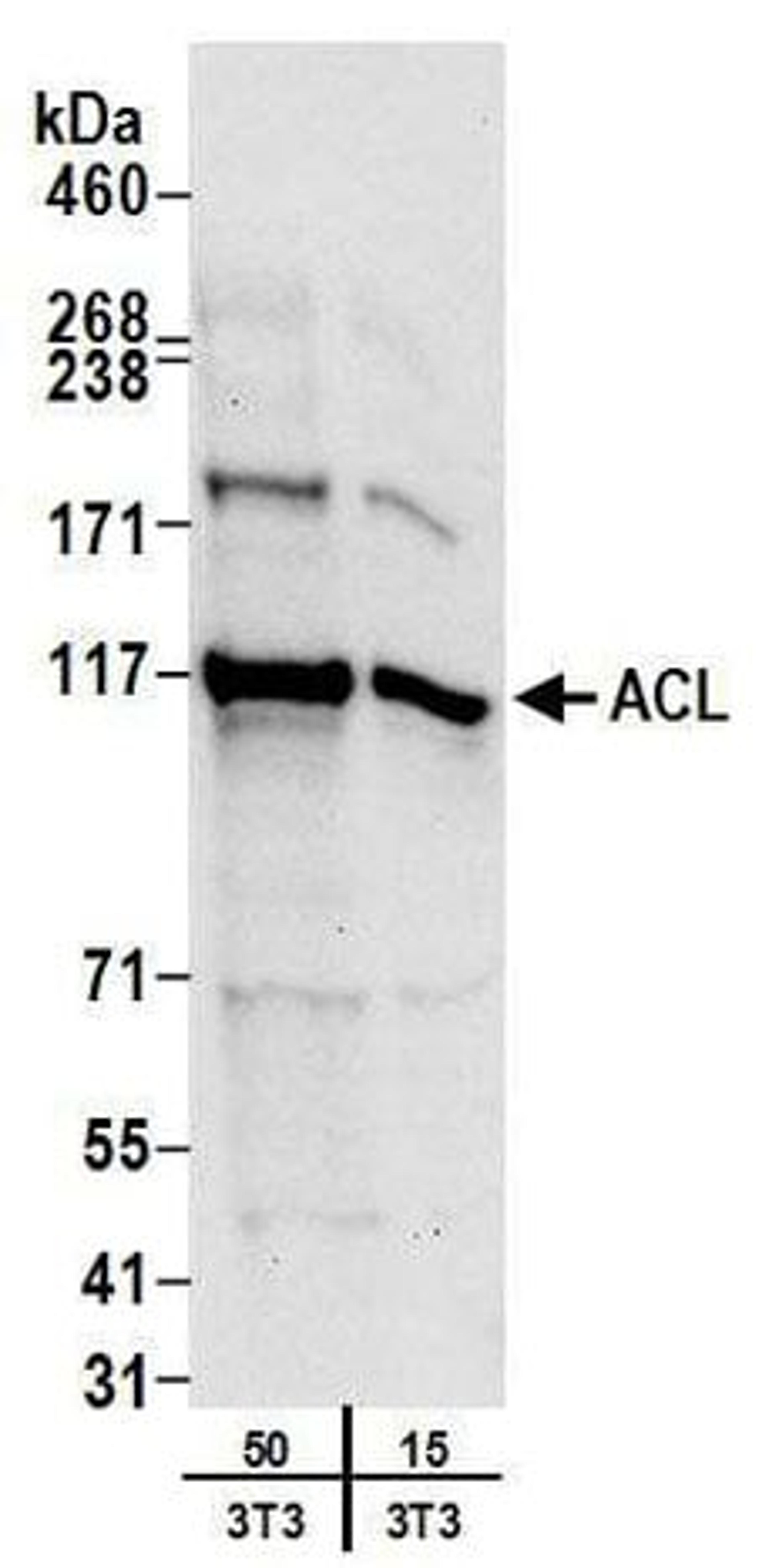 Detection of mouse ACL by western blot.