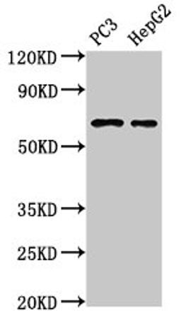 Western Blot. Positive WB detected in: PC-3 whole cell lysate, HepG2 whole cell lysate. All lanes: PARP2 antibody at 3µg/ml. Secondary. Goat polyclonal to rabbit IgG at 1/50000 dilution. Predicted band size: 67, 65 kDa. Observed band size: 67 kDa