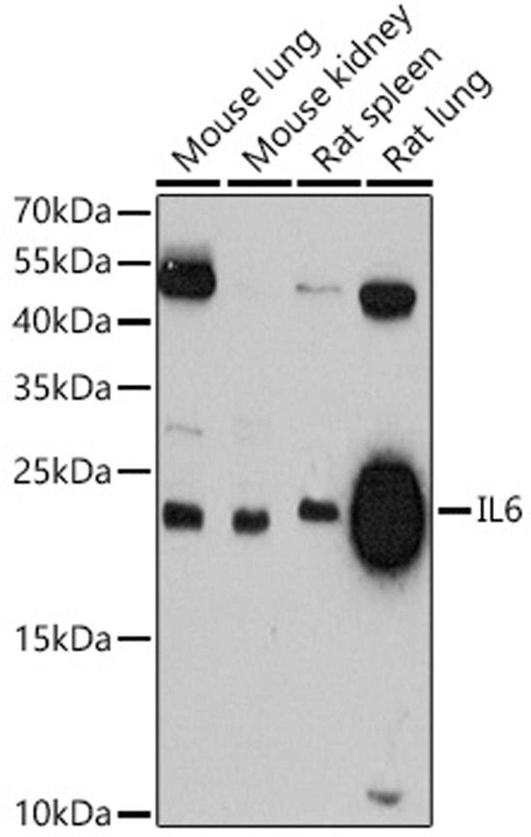 Western blot - IL6 antibody (A11115)