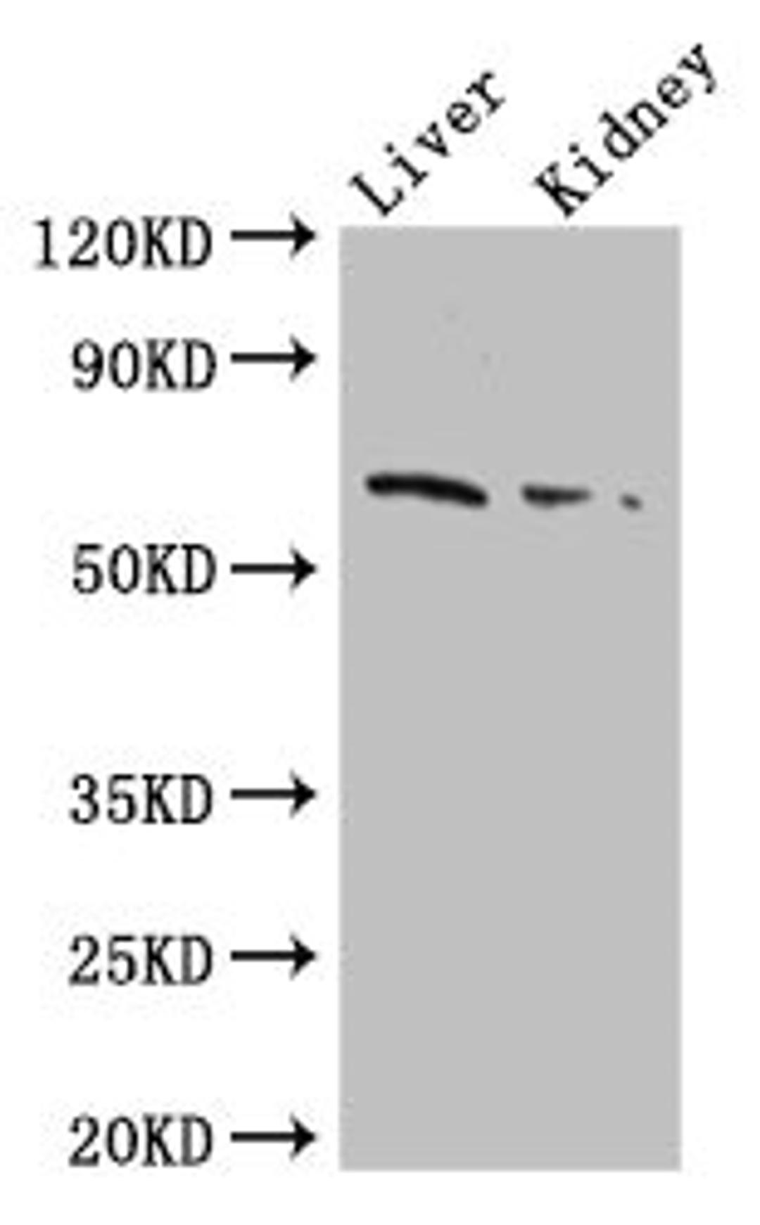 Western Blot. Positive WB detected in: Mouse liver tissue, Mouse kidney tissue. All lanes: FZD9 antibody at 2.5ug/ml. Secondary. Goat polyclonal to rabbit IgG at 1/50000 dilution. Predicted band size: 65 kDa. Observed band size: 65 kDa. 