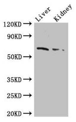 Western Blot. Positive WB detected in: Mouse liver tissue, Mouse kidney tissue. All lanes: FZD9 antibody at 2.5ug/ml. Secondary. Goat polyclonal to rabbit IgG at 1/50000 dilution. Predicted band size: 65 kDa. Observed band size: 65 kDa. 