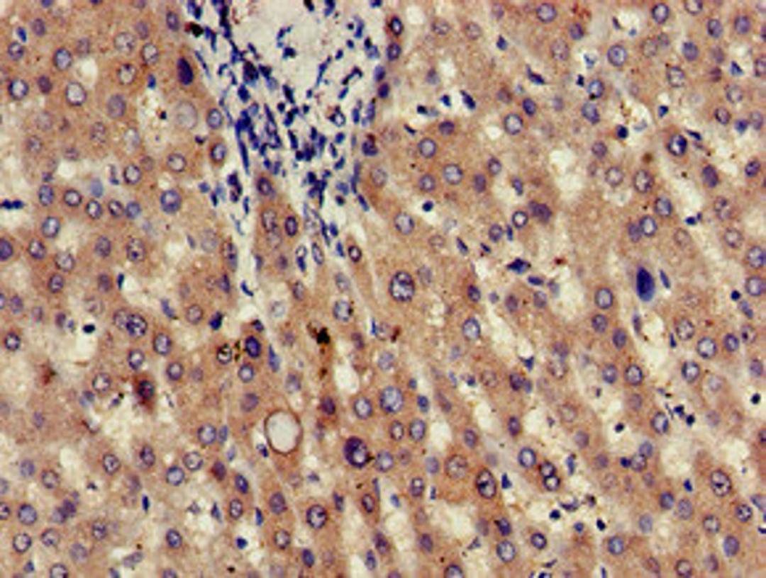Immunohistochemistry of paraffin-embedded human liver tissue using CSB-PA01949A0Rb at dilution of 1:100