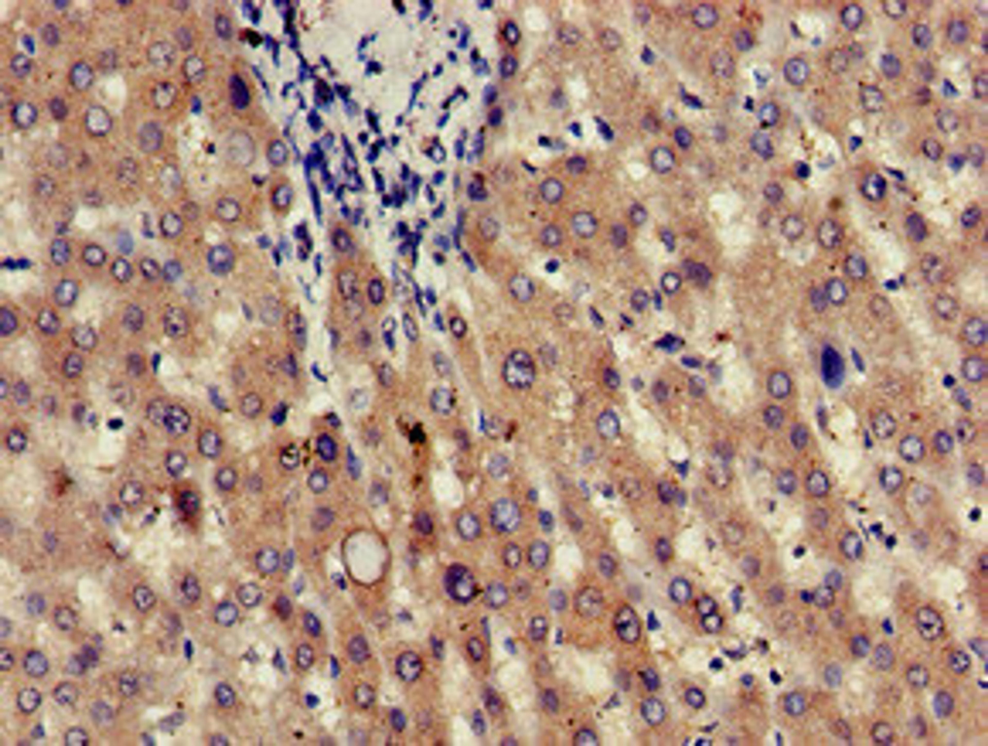 Immunohistochemistry of paraffin-embedded human liver tissue using CSB-PA01949A0Rb at dilution of 1:100