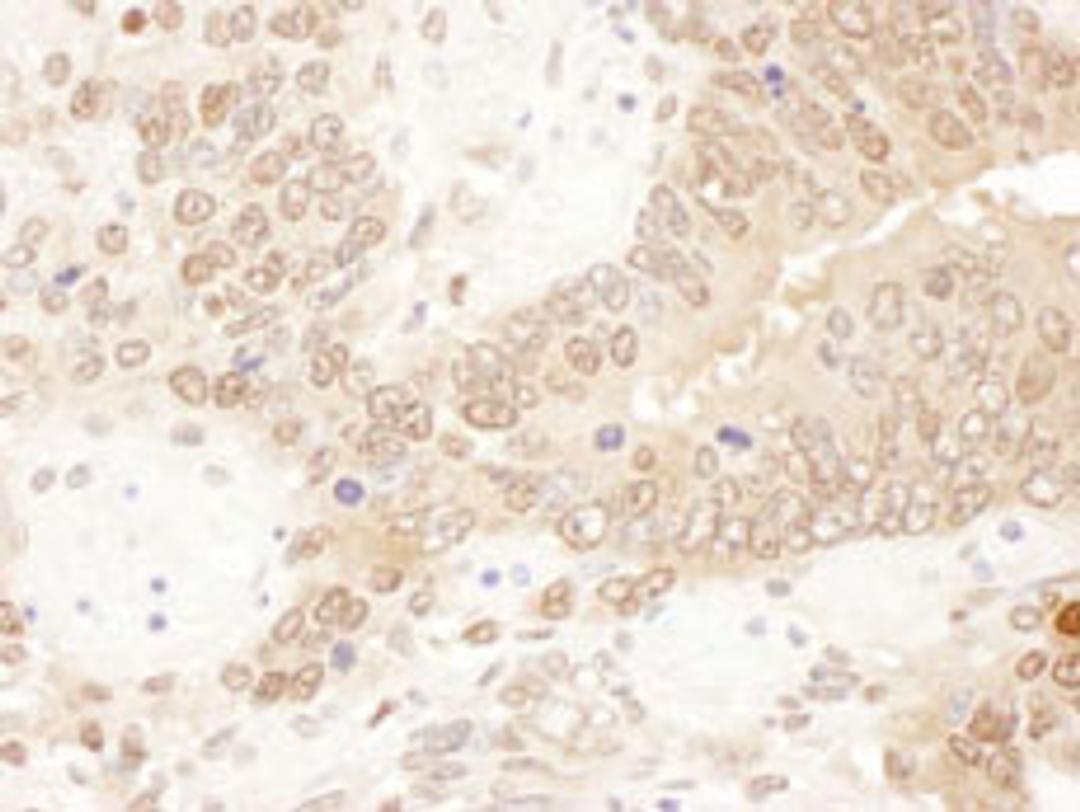 Detection of mouse ACAT2 by immunohistochemistry.