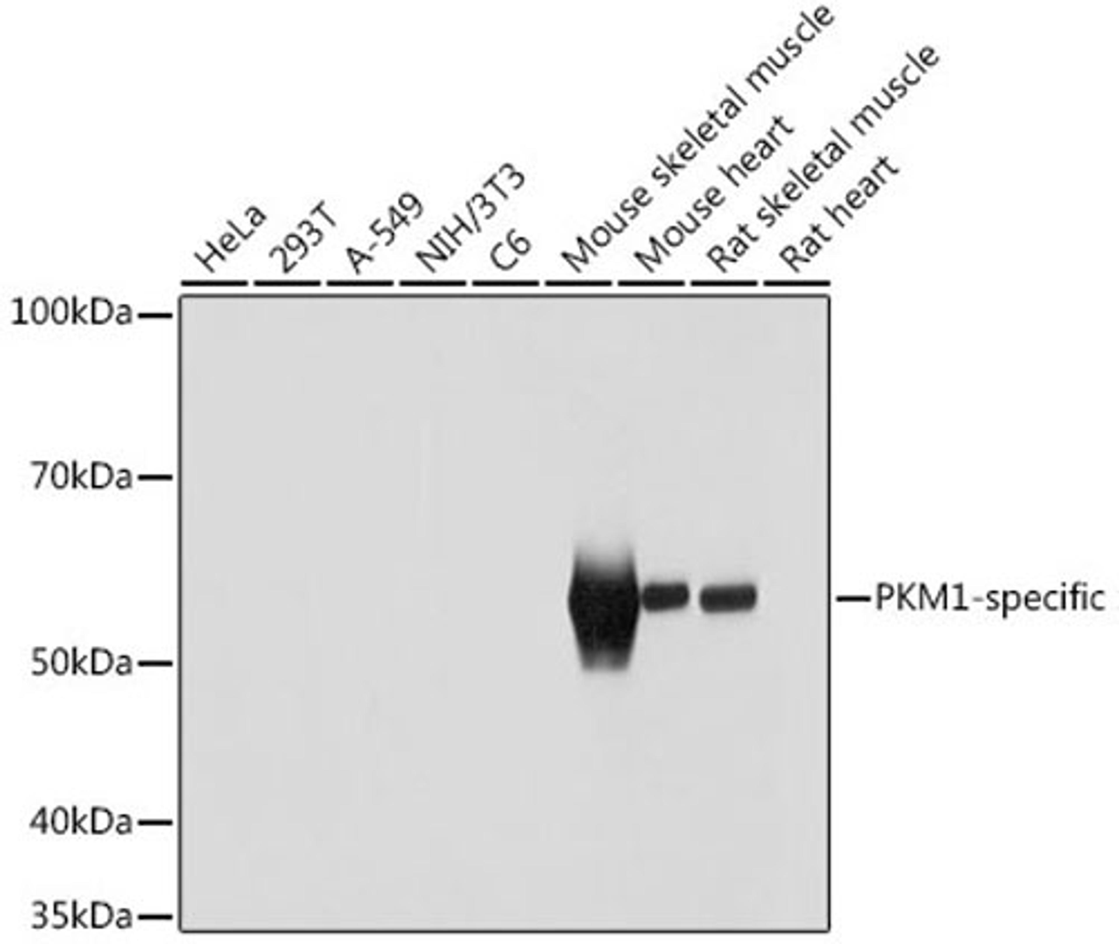 Immunohistochemistry  - PKM1-specific Rabbit pAb (A18800)