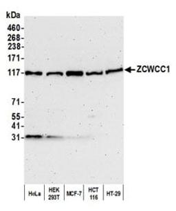 Detection of human ZCWCC1 by western blot.