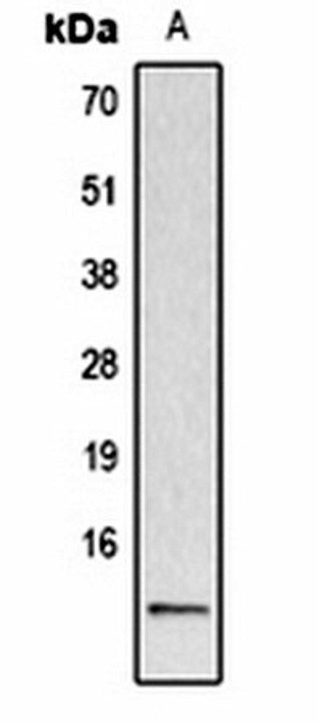 Western blot analysis of  Hela TSA-treated (Lane1) whole cell lysates using Histone H2A (AcK5) antibody