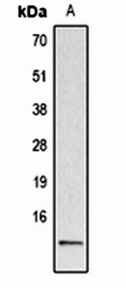 Western blot analysis of  Hela TSA-treated (Lane1) whole cell lysates using Histone H2A (AcK5) antibody