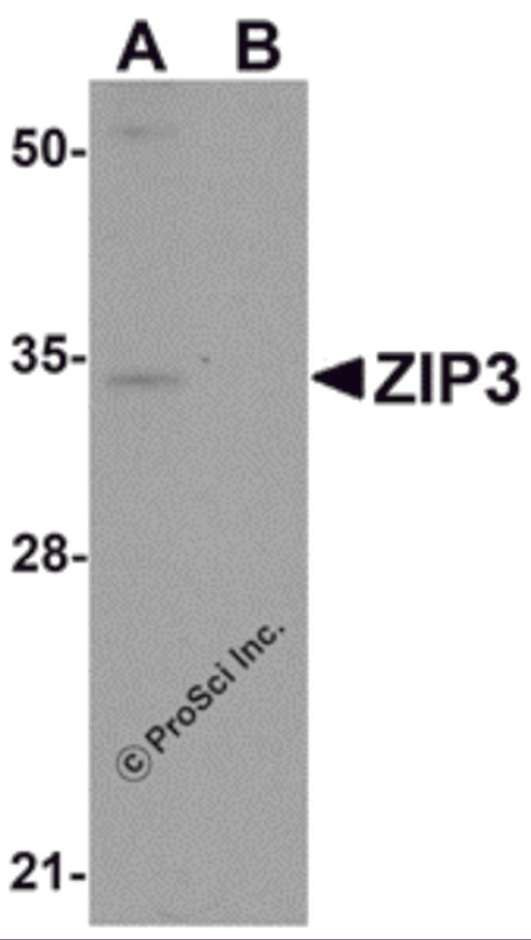 Western blot analysis of ZIP3 in mouse lung tissue lysate with ZIP3 antibody at 1 μg/mL in (A) the absence and (B) the presence of blocking peptide.