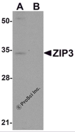 Western blot analysis of ZIP3 in mouse lung tissue lysate with ZIP3 antibody at 1 μg/mL in (A) the absence and (B) the presence of blocking peptide.