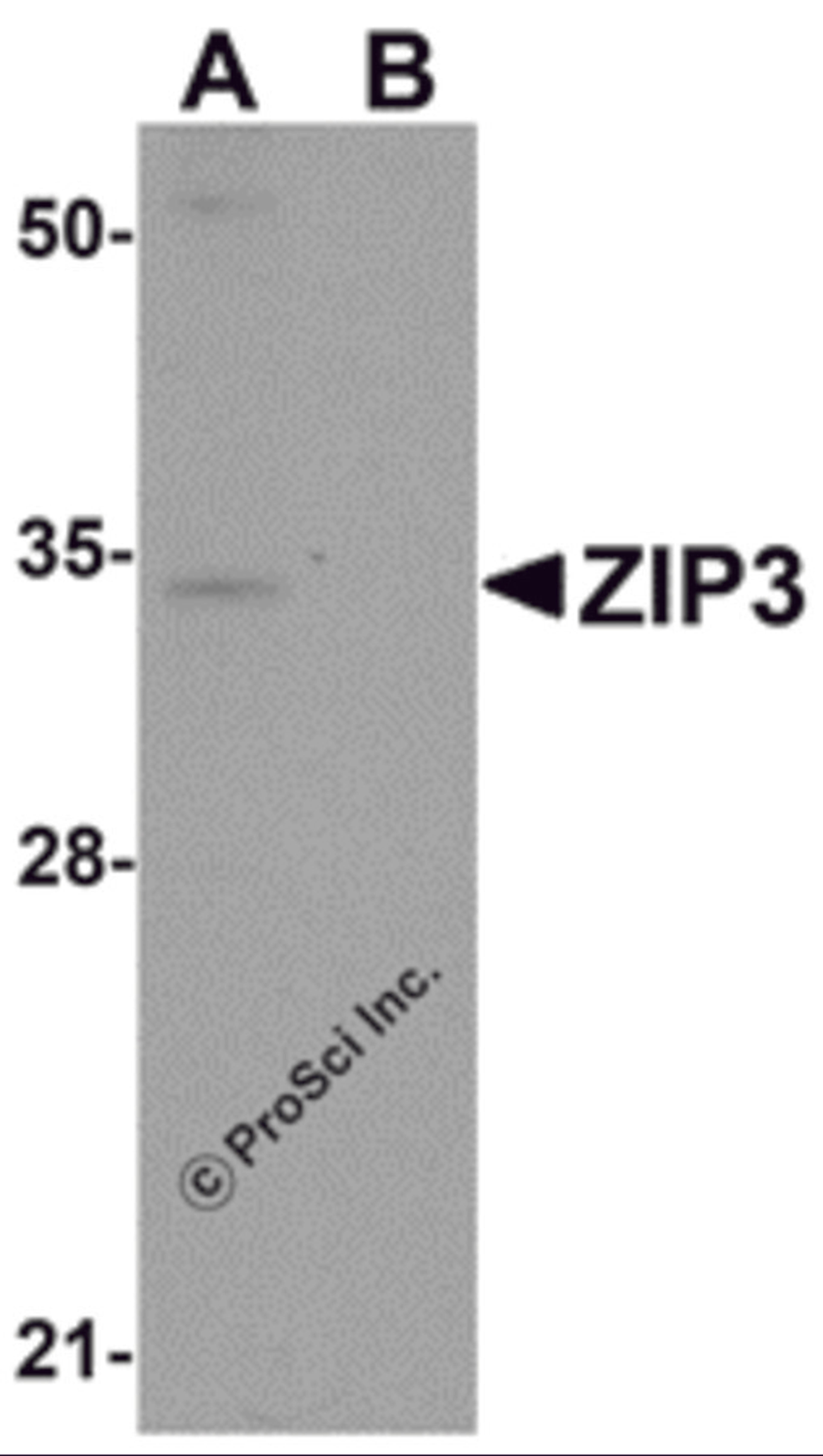 Western blot analysis of ZIP3 in mouse lung tissue lysate with ZIP3 antibody at 1 μg/mL in (A) the absence and (B) the presence of blocking peptide.
