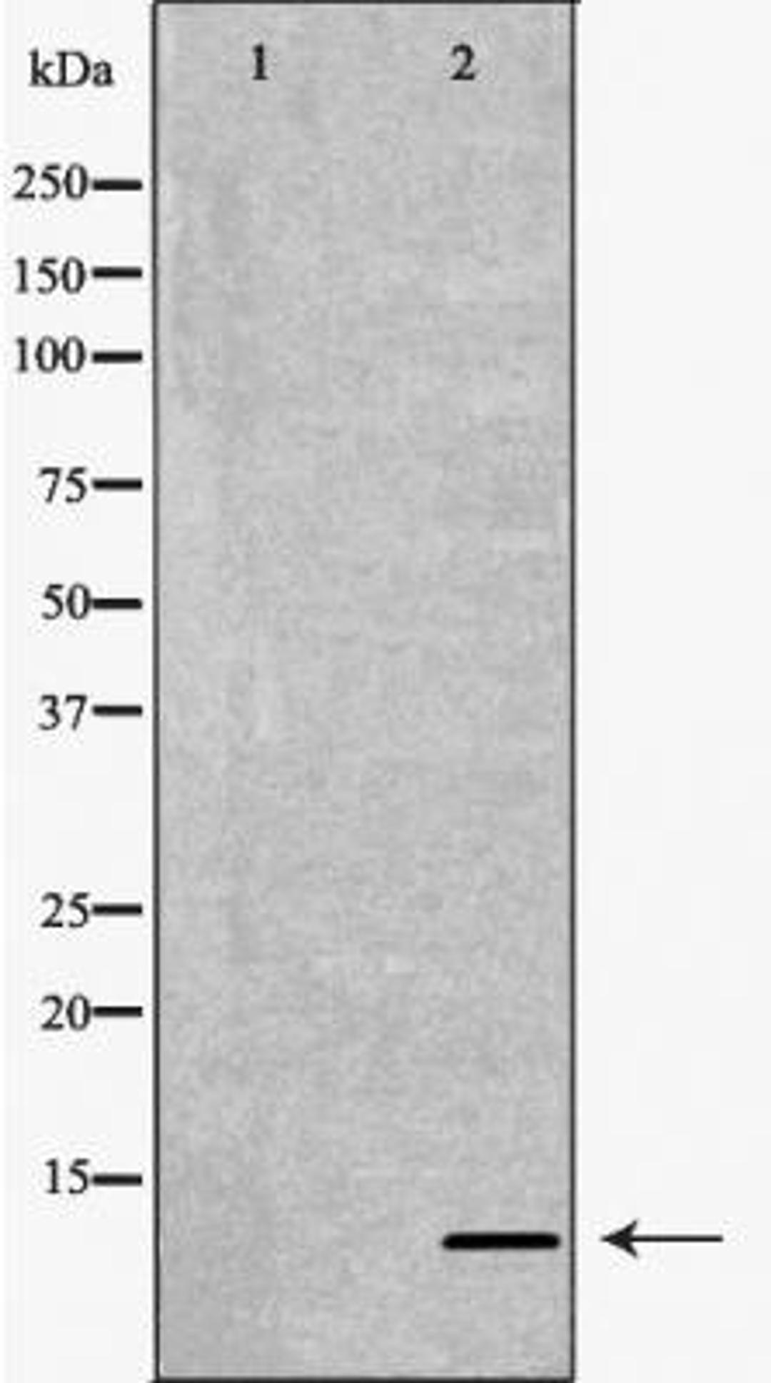 Western blot analysis of various cell lines using P16 antibody