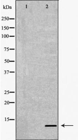 Western blot analysis of various cell lines using P16 antibody