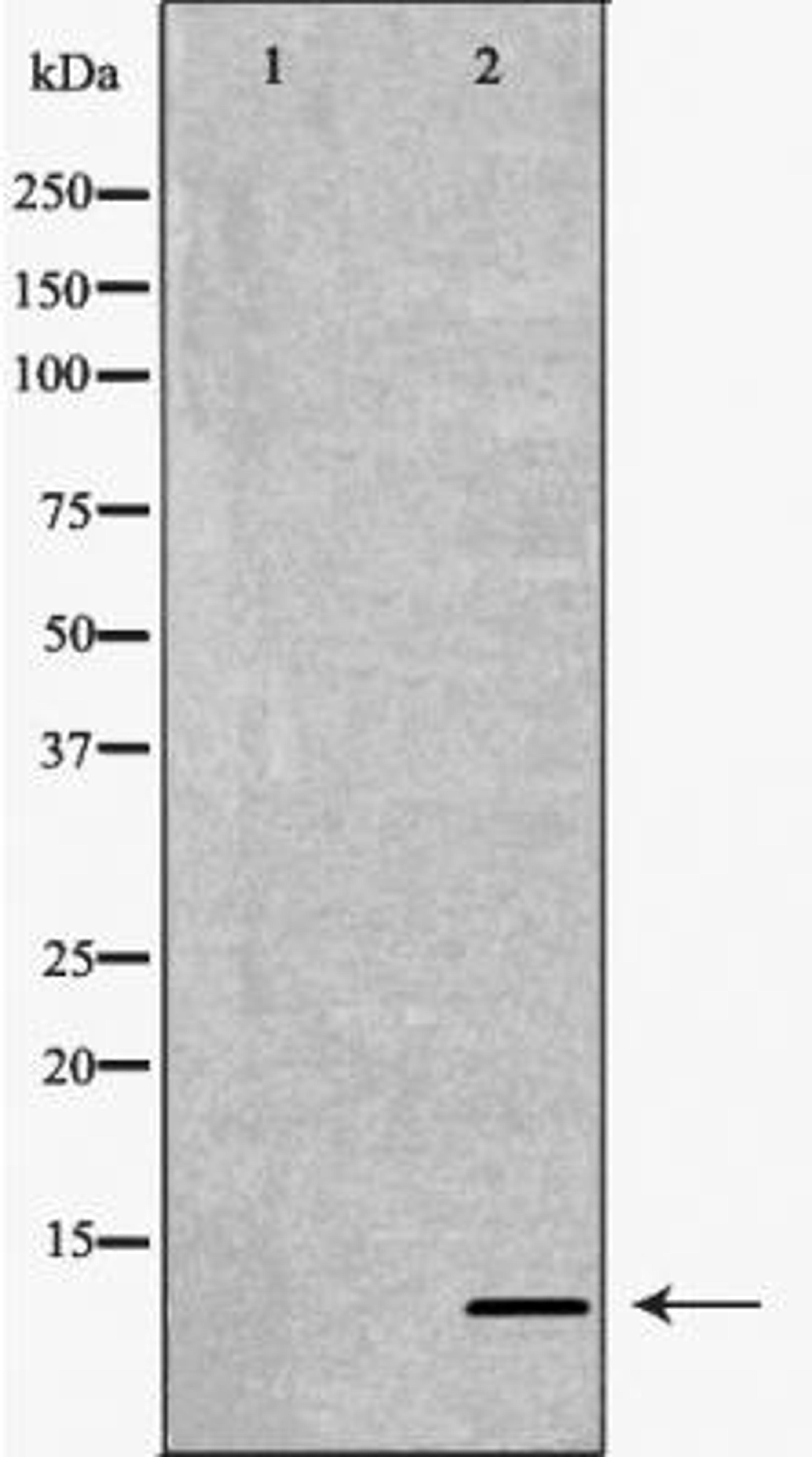 Western blot analysis of various cell lines using P16 antibody