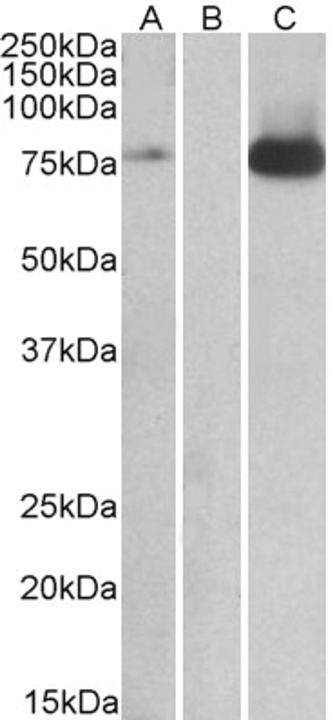 HEK293 lysate (10ug protein in RIPA buffer) overexpressing Human MAP3K7 with DYKDDDDK tag probed with 46-469 (1ug/ml) in Lane A and probed with anti- DYKDDDDK Tag (1/3000) in lane C. Mock-transfected HEK293 probed with 46-469 (1mg/ml) in Lane B. Primary