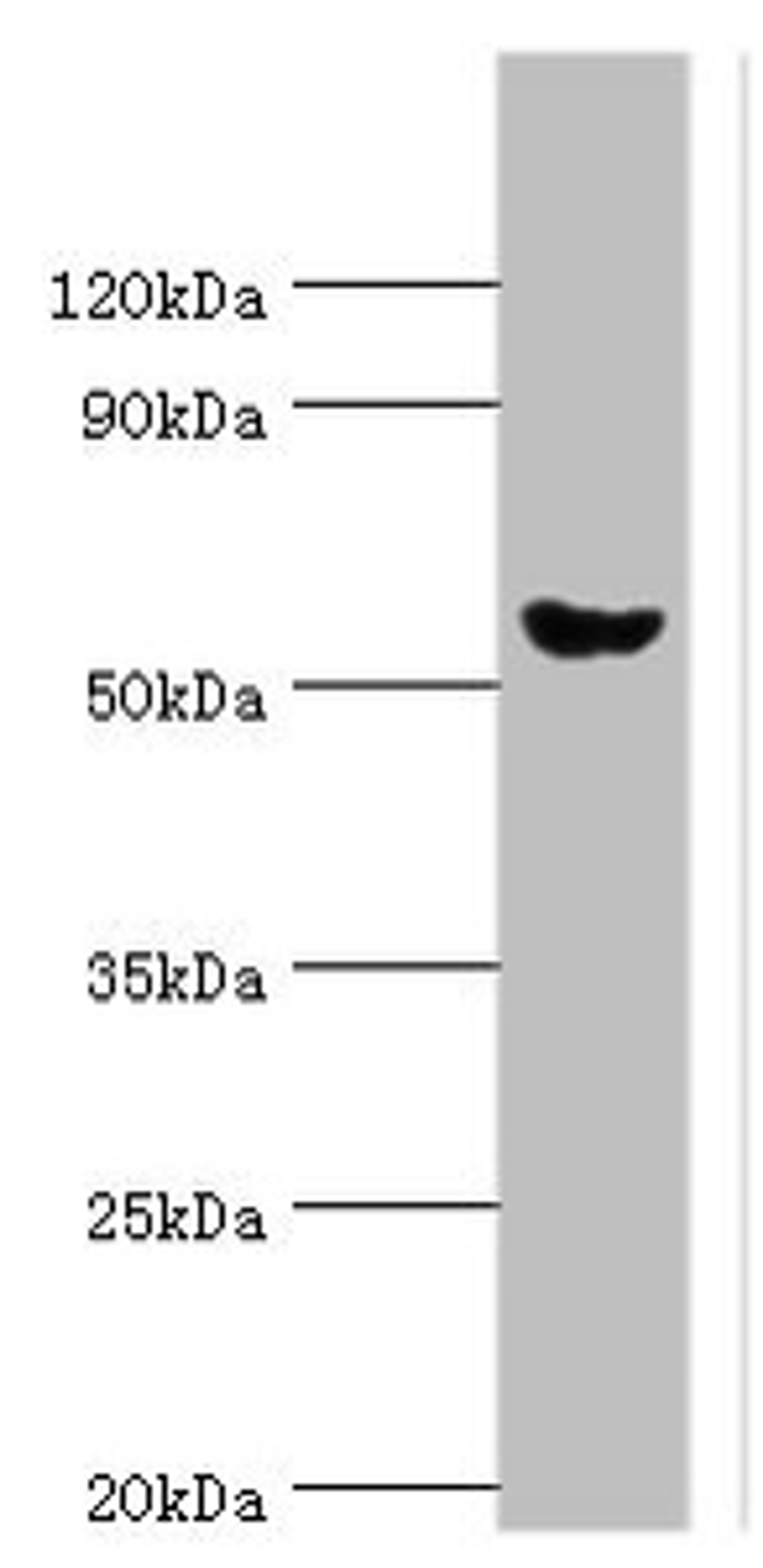 Western blot. All lanes: Pancreatic alpha-amylase antibody at 6ug/ml + Mouse liver tissue. Secondary. Goat polyclonal to rabbit IgG at 1/10000 dilution. Predicted band size: 58, 31 kDa. Observed band size: 58 kDa.