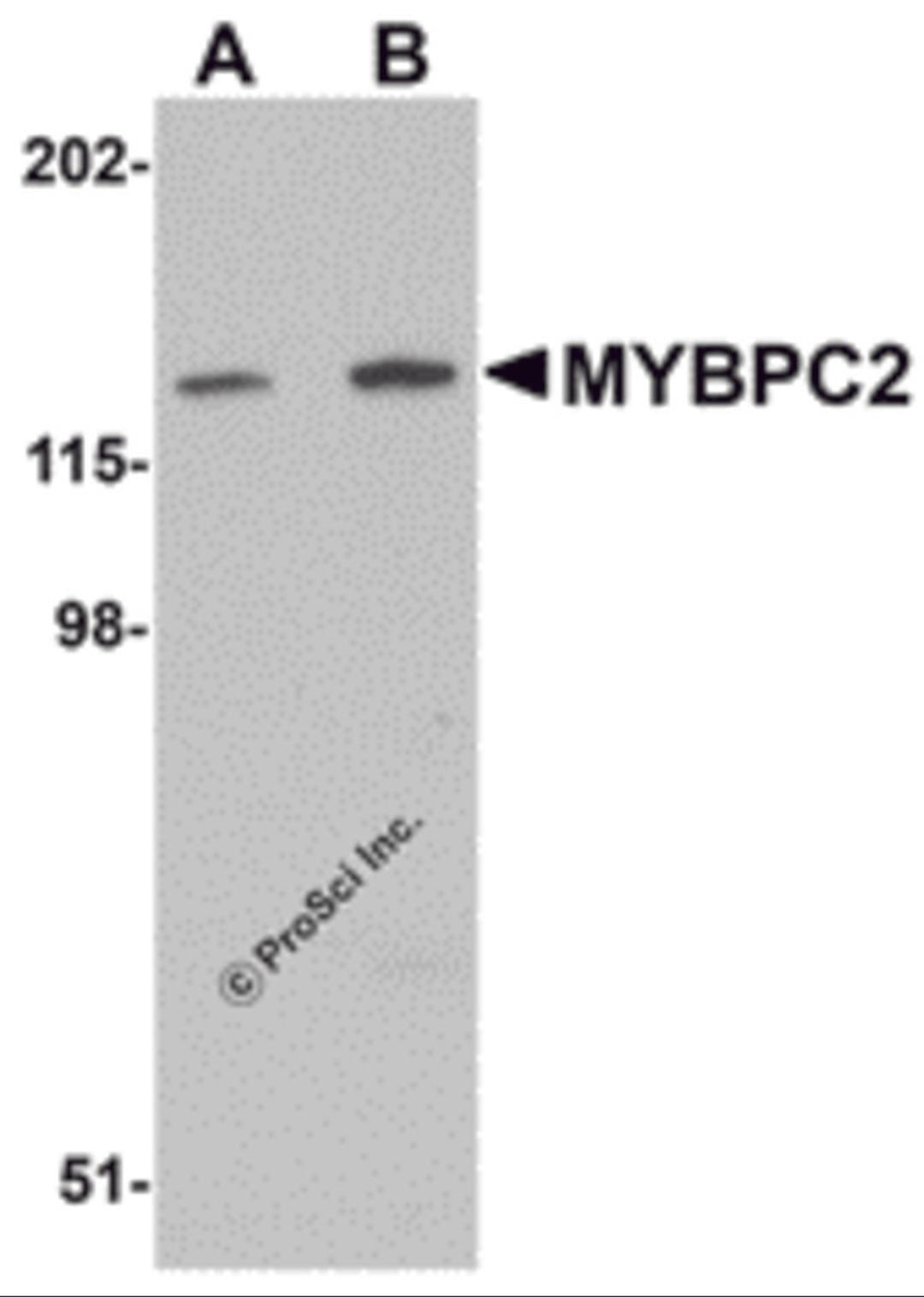 Western blot analysis of MYBPC2 in mouse skeletal muscle tissue lysate with MYBPC2 antibody at (A) 1 and (B) 2 &#956;g/mL.