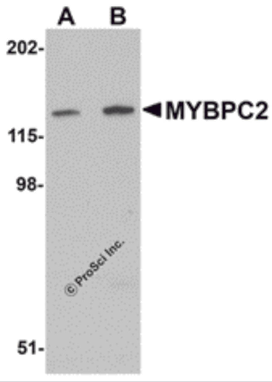 Western blot analysis of MYBPC2 in mouse skeletal muscle tissue lysate with MYBPC2 antibody at (A) 1 and (B) 2 μg/mL.