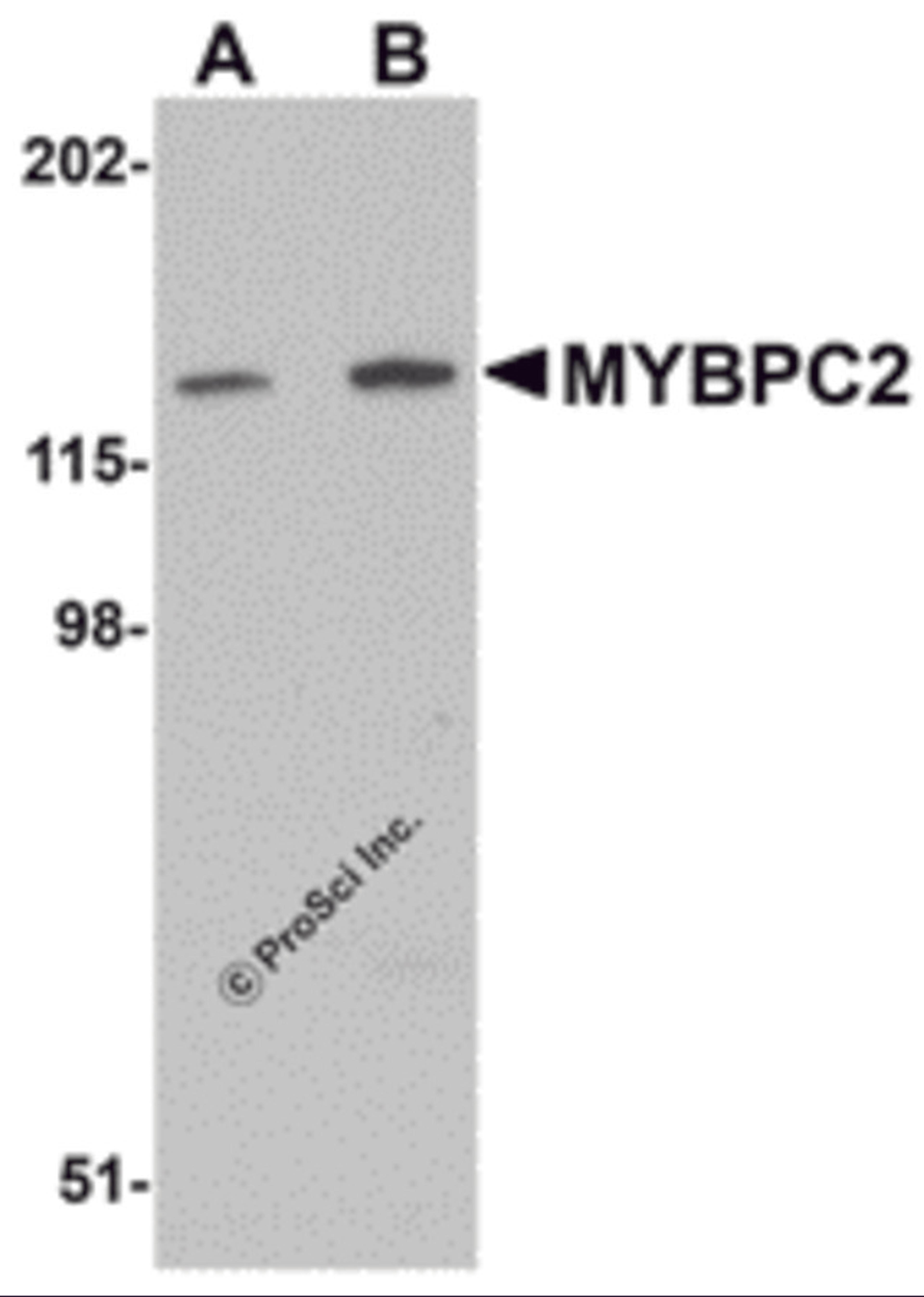 Western blot analysis of MYBPC2 in mouse skeletal muscle tissue lysate with MYBPC2 antibody at (A) 1 and (B) 2 μg/mL.