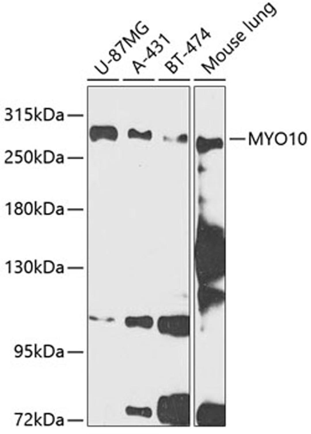 Western blot - MYO10 antibody (A12466)