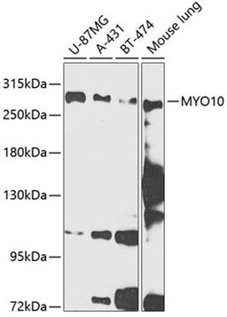 Western blot - MYO10 antibody (A12466)