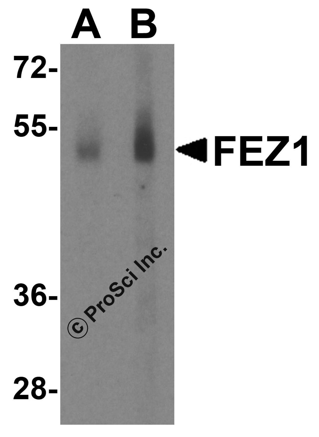 Western blot analysis of SAPAP2 in Raji cell lysate with SAPAP2 antibody at (A) 0.5 and (B) 1 &#956;g/mL.