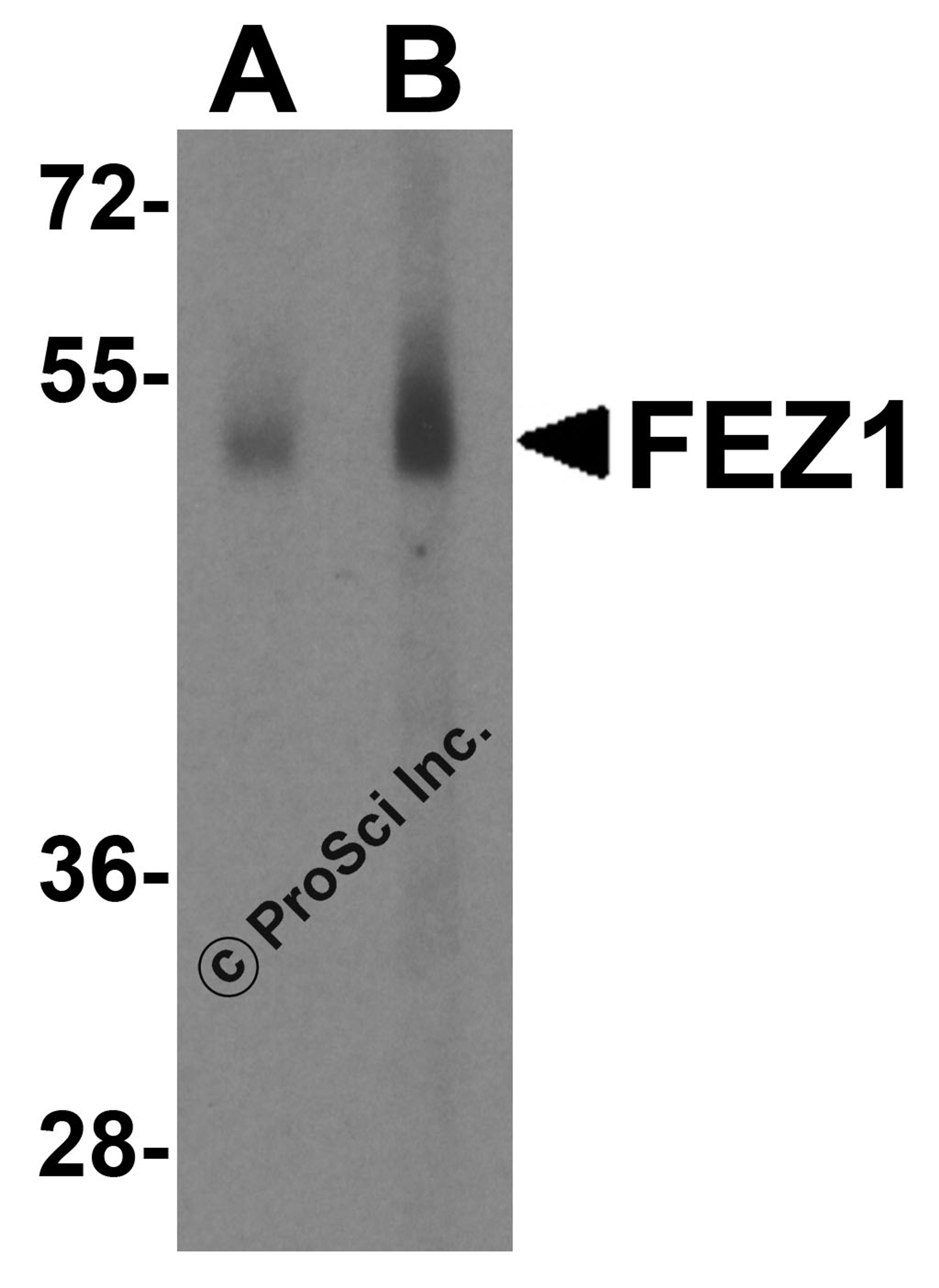 Western blot analysis of SAPAP2 in Raji cell lysate with SAPAP2 antibody at (A) 0.5 and (B) 1 &#956;g/mL.