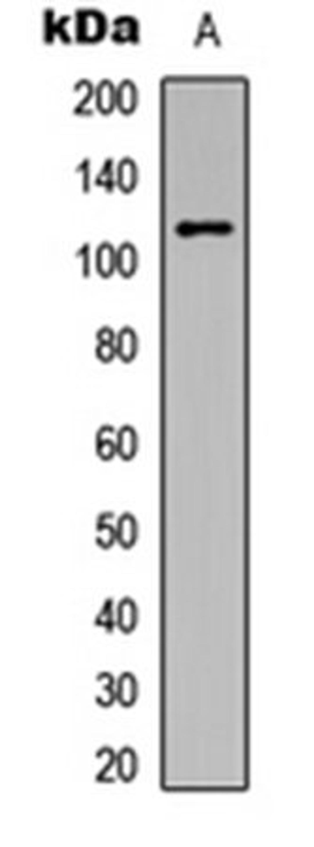 Western blot analysis of HeLa (Lane 1) whole cell lysates using PKC mu (pY463) antibody