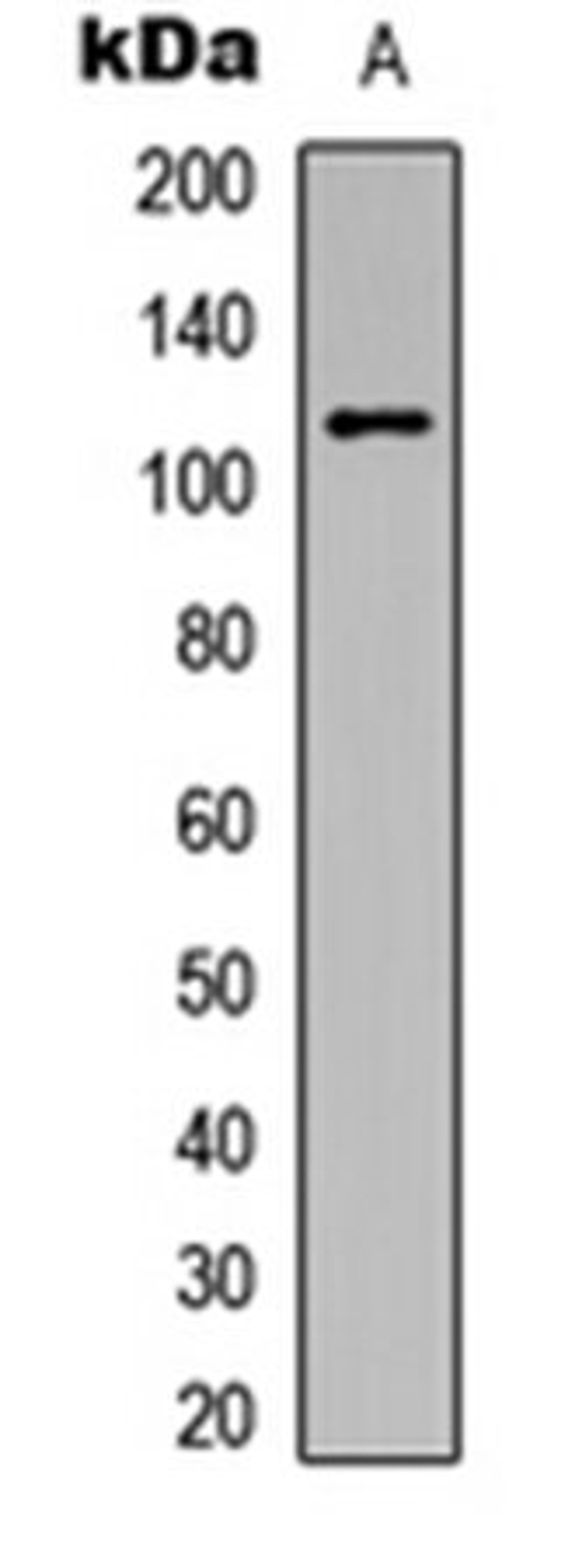 Western blot analysis of HeLa (Lane 1) whole cell lysates using PKC mu (pY463) antibody