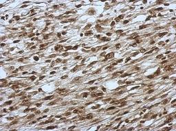 Immunohistochemistry-Paraffin: SLU7 Antibody [NBP2-20403] - Immunohistochemical analysis of paraffin-embedded C2C12 xenograft, using antibody at 1:500 dilution.