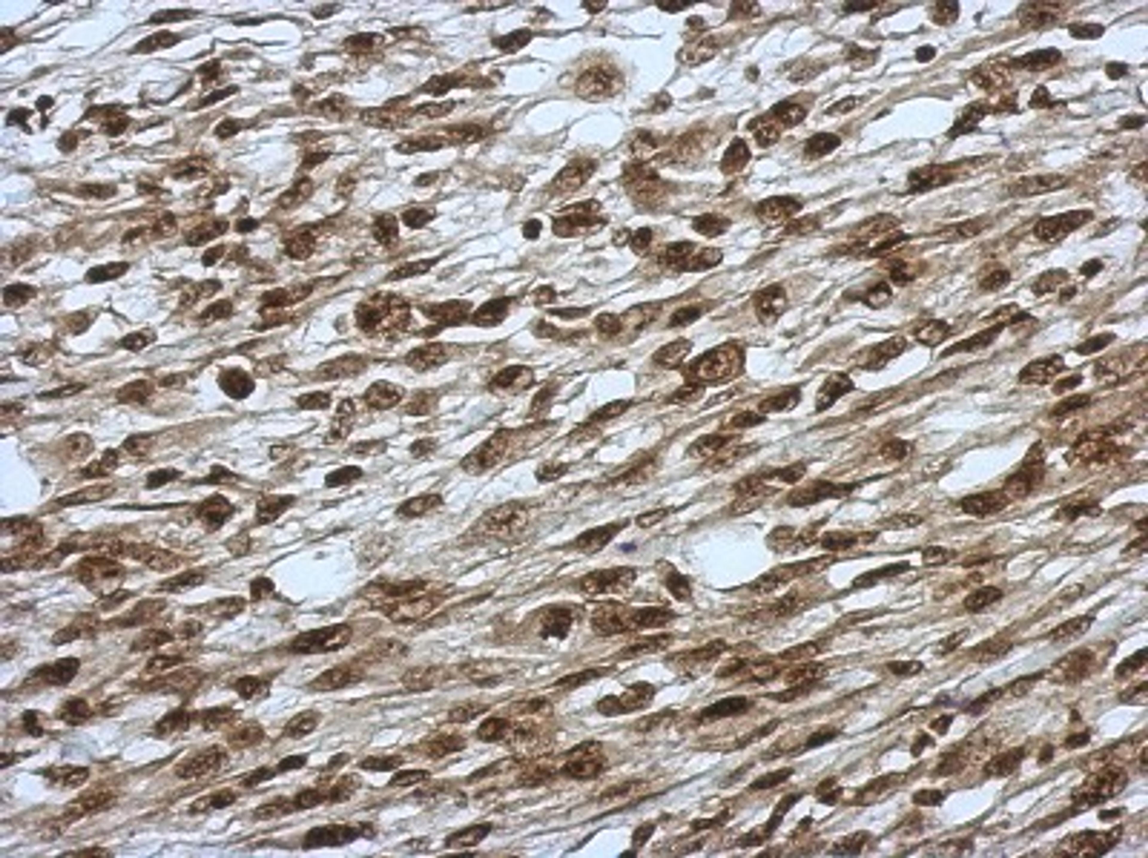 Immunohistochemistry-Paraffin: SLU7 Antibody [NBP2-20403] - Immunohistochemical analysis of paraffin-embedded C2C12 xenograft, using antibody at 1:500 dilution.