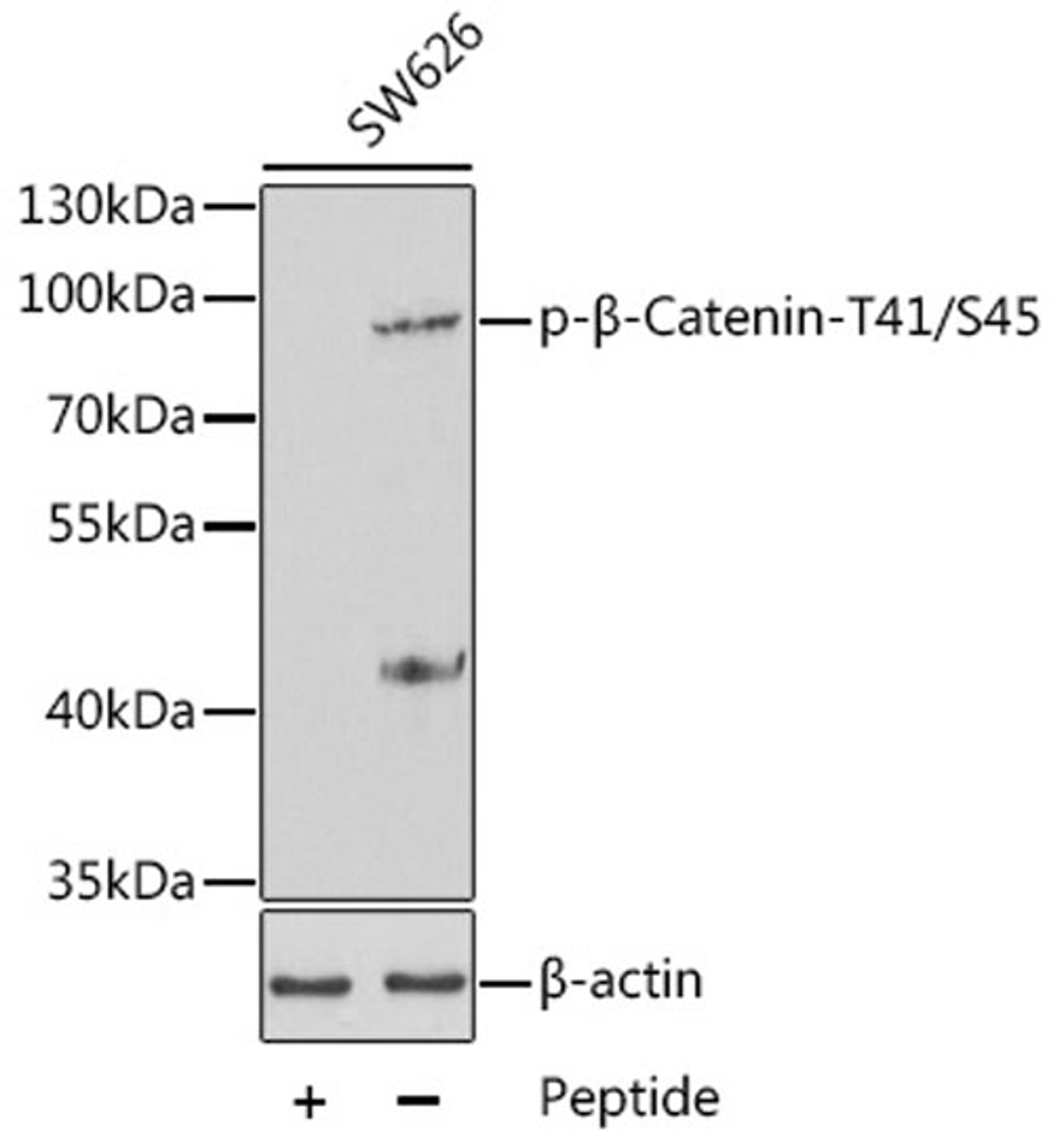 Western blot - Phospho-ß-Catenin-T41/S45 antibody (AP0336)