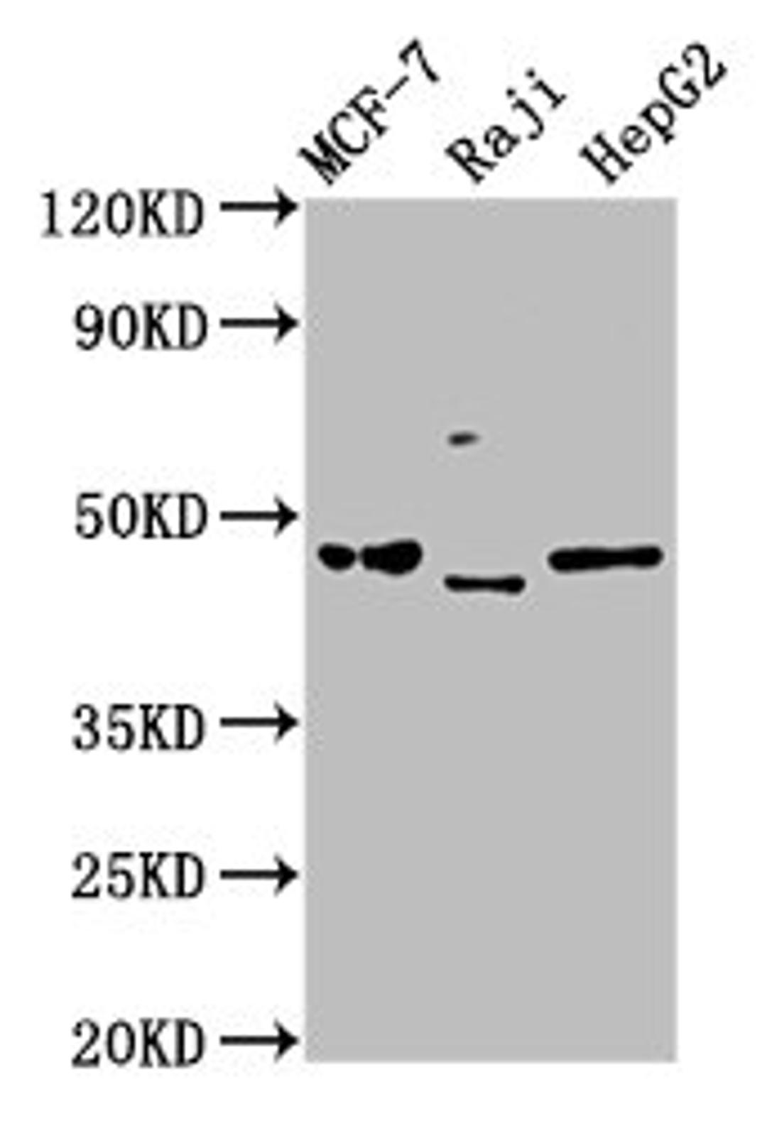 Western Blot. Positive WB detected in: MCF-7 whole cell lysate, Raji whole cell lysate, HepG2 whole cell lysate. All lanes: SERPINA11 antibody at 5µg/ml. Secondary. Goat polyclonal to rabbit IgG at 1/50000 dilution. Predicted band size: 47 kDa. Observed band size: 47 kDa