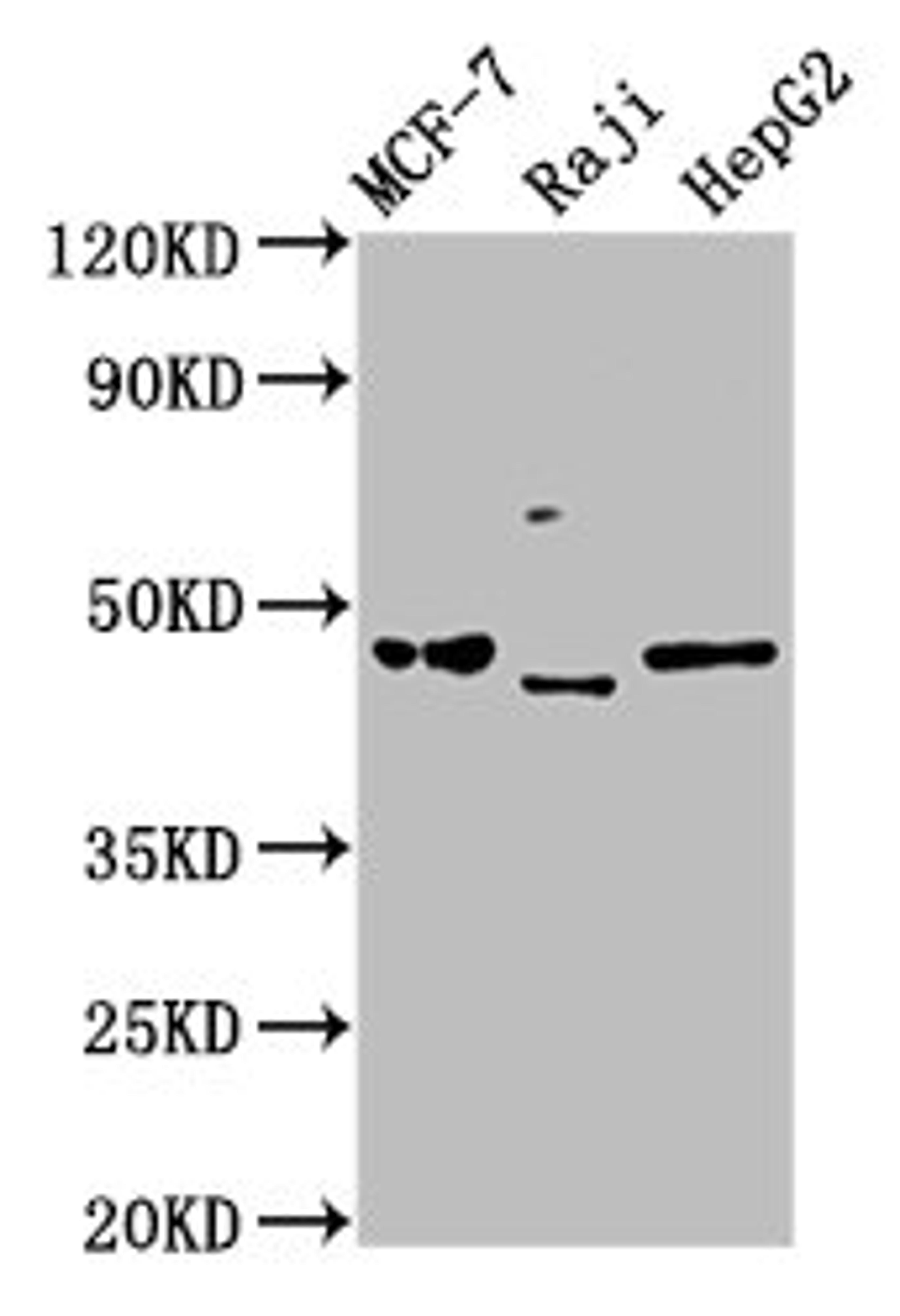 Western Blot. Positive WB detected in: MCF-7 whole cell lysate, Raji whole cell lysate, HepG2 whole cell lysate. All lanes: SERPINA11 antibody at 5µg/ml. Secondary. Goat polyclonal to rabbit IgG at 1/50000 dilution. Predicted band size: 47 kDa. Observed band size: 47 kDa