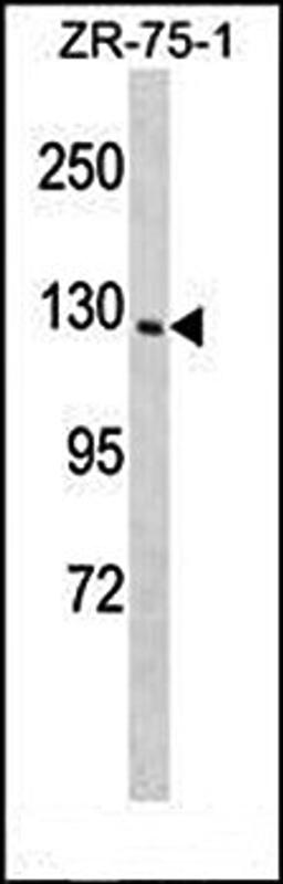 Western blot analysis of ZR-75-1 cell line lysates (35ug/lane) using PITPNM1 (N-term) antibody